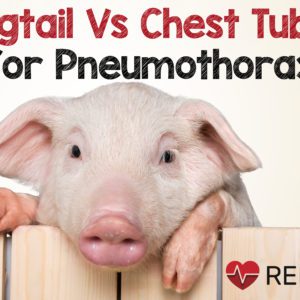 Pigtail Catheter vs Large Bore Chest Tube for Pneumothorax – MED-TAC ...