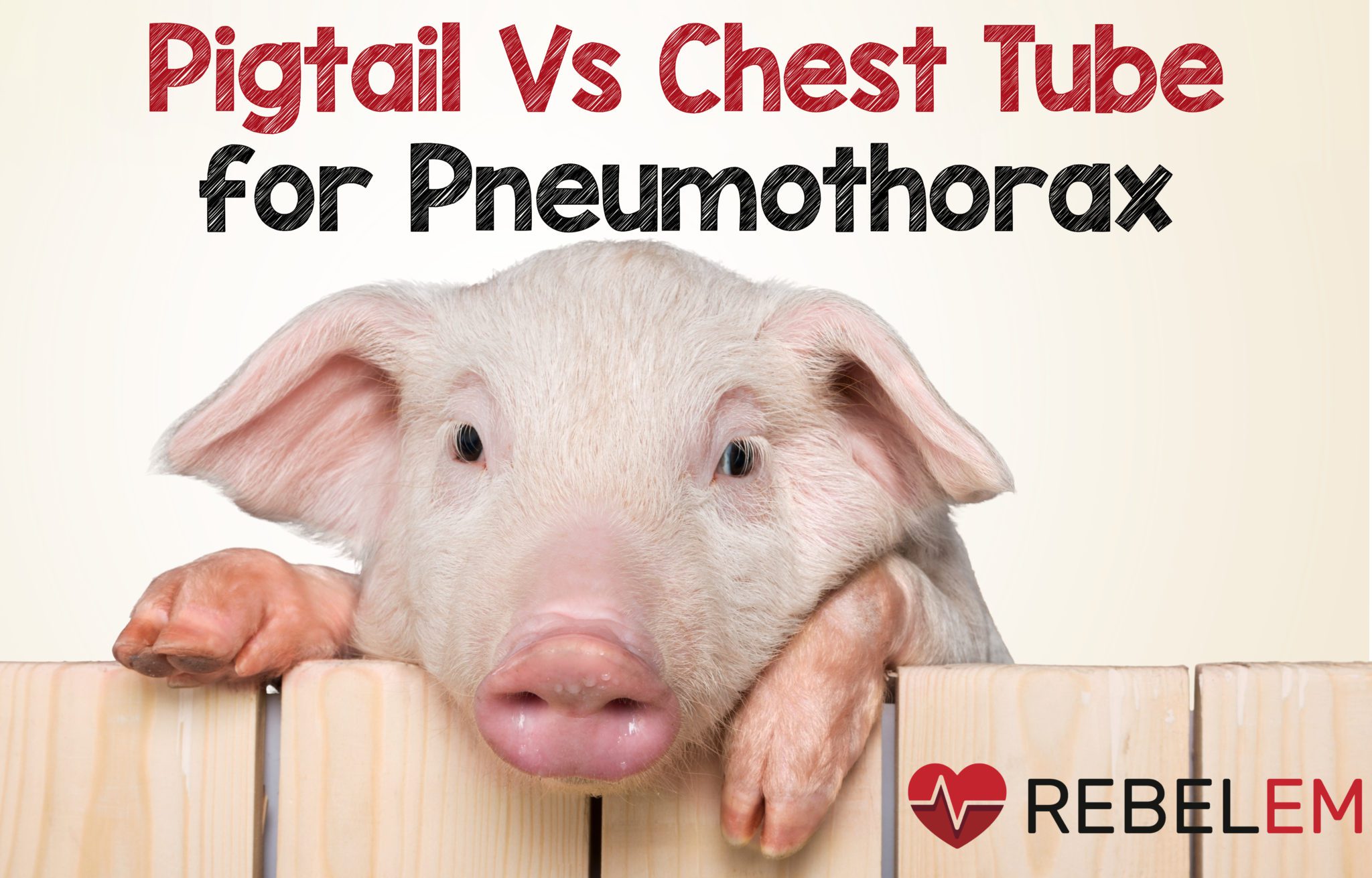 Pigtail Catheter vs Large Bore Chest Tube for Pneumothorax - REBEL EM -  Emergency Medicine Blog