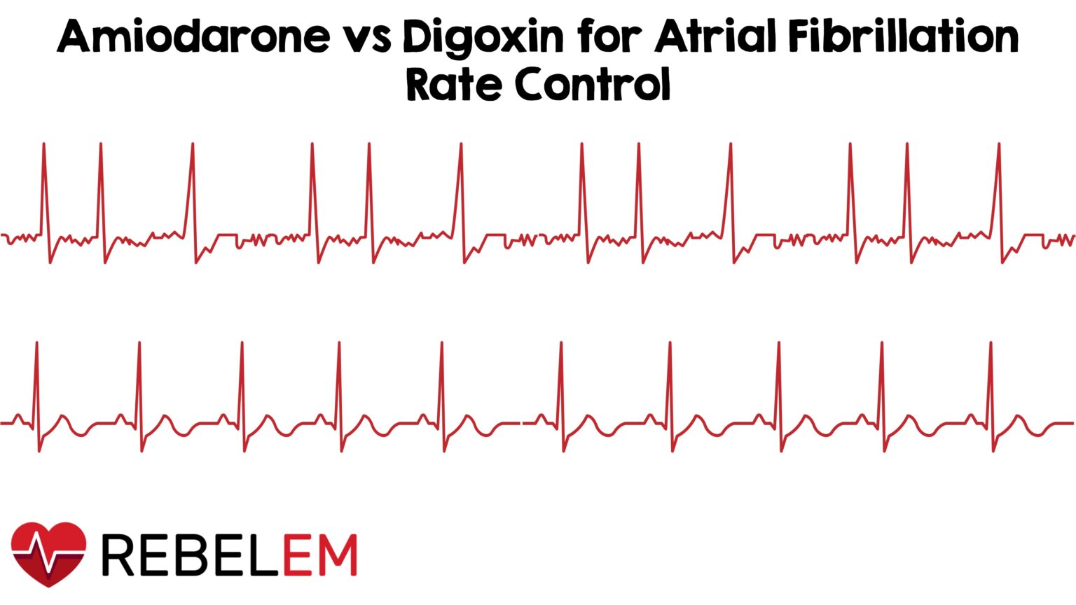 Amiodarone versus digoxin for acute rate control of atrial fibrillation