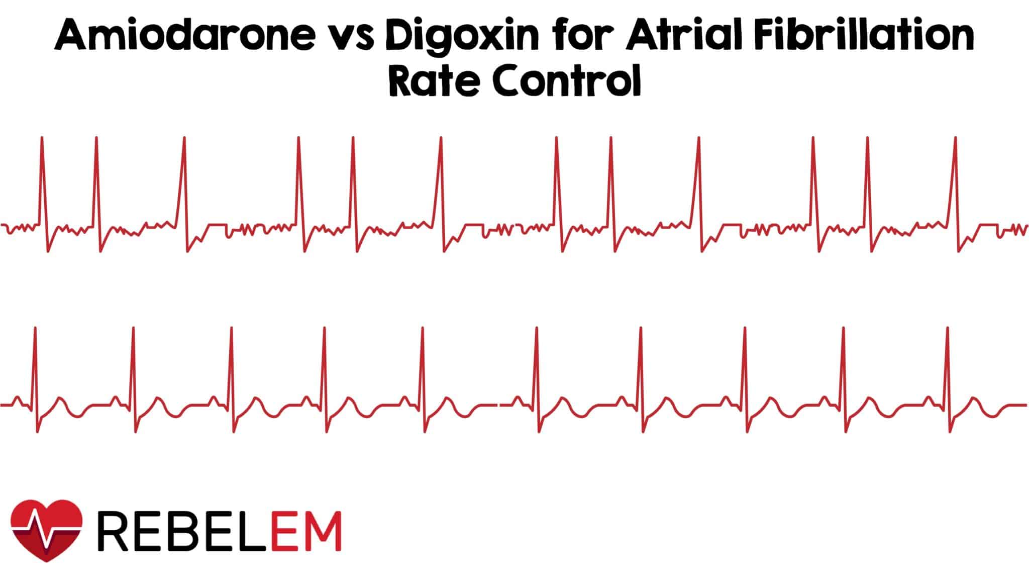 Amiodarone Versus Digoxin for Rate of Atrial Fibrillation in the Emergency Department - REBEL EM - Emergency Medicine Blog