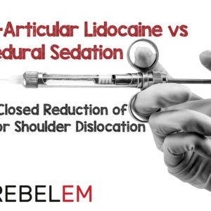 Intra-articular Lidocaine Vs Procedural Sedation And Analgesia For Clo ...