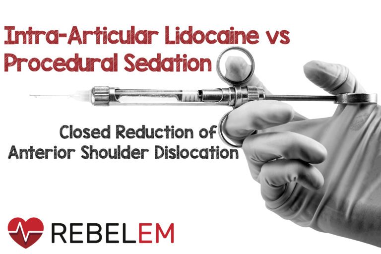 Intraarticular Lidocaine vs Procedural Sedation and Analgesia for