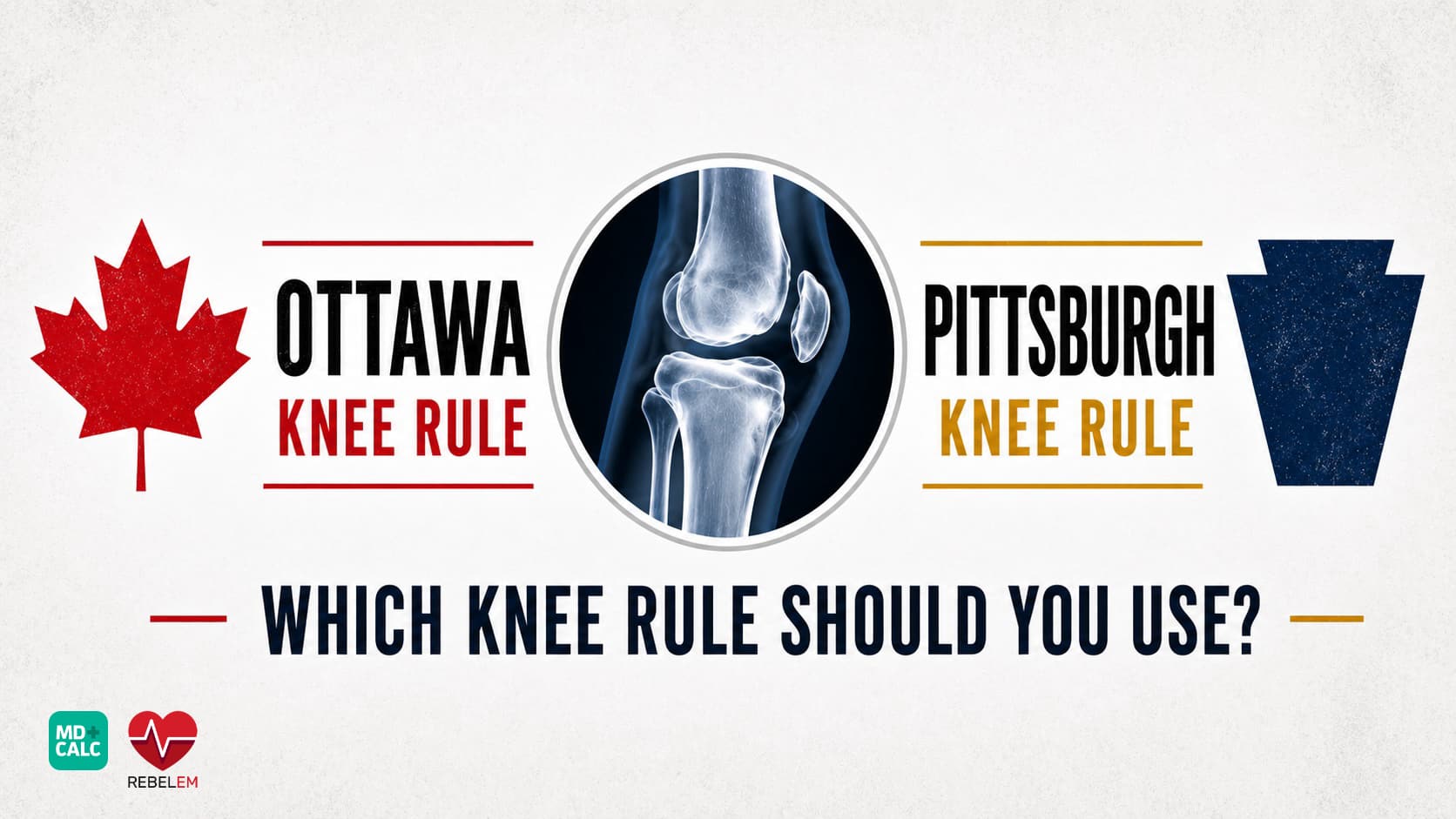 MDCalc Wars: Ottawa vs Pittsburgh — Which Knee Rule Should You Use?